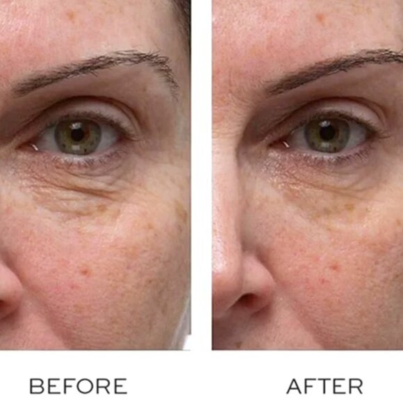 NIB Elemis Peptide 4 Eye Recovery Reviving Eye Cream Full Size - Picture 5 of 8